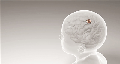 万向注册：首例脑机接口设备人体移植完成